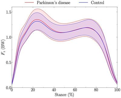 Isolating the speed factor is crucial in gait analysis for Parkinson’s disease